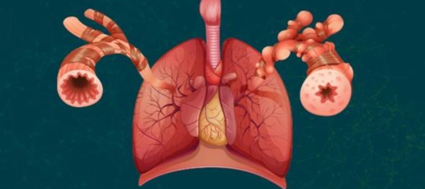 Dr. Sheetu Singh – Trusted Lung Specialist in Jaipur, Rajasthan