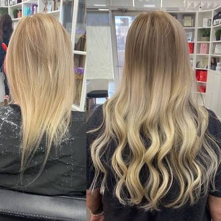 Discover Expert Hair Loss Solutions at Dallas