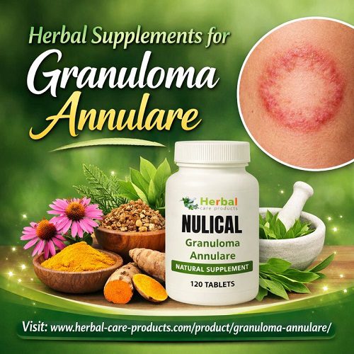 Natural Supplements for Granuloma Annulare Skin Lesions fast